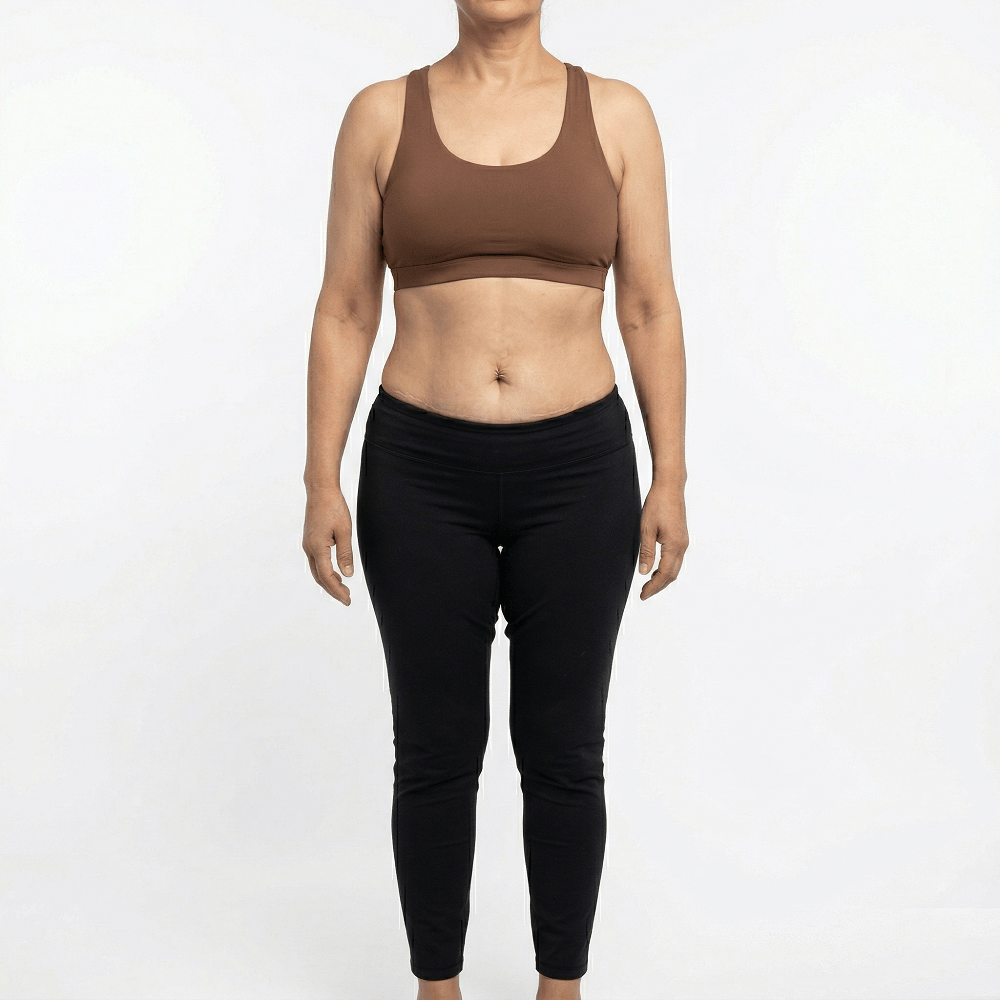 Headless clinical after photograph of the same Middle Eastern woman, displaying a dramatically sculpted, athletic physique with carved six pack abs and defined muscle tone following an advanced surgical body contouring procedure at Dina Elite, serving the Gulf region 