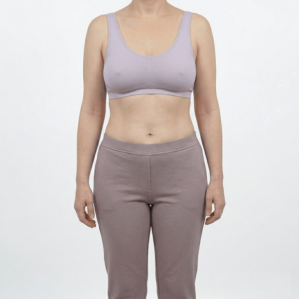 Headless clinical after photograph of the same woman displaying a dramatically flat, rejuvenated abdomen and a lifted, proportional breast contour following a complete Mommy Makeover at Dina Elite for GCC patients 