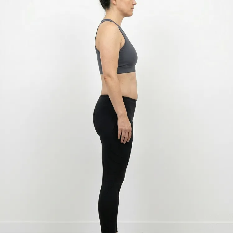 Side profile view of a patient before Brazilian Butt Lift (BBL) surgery at Dina Elite  Note the lack of projection in the buttock area and localized fat deposits on the flanks and waist (donor areas) 