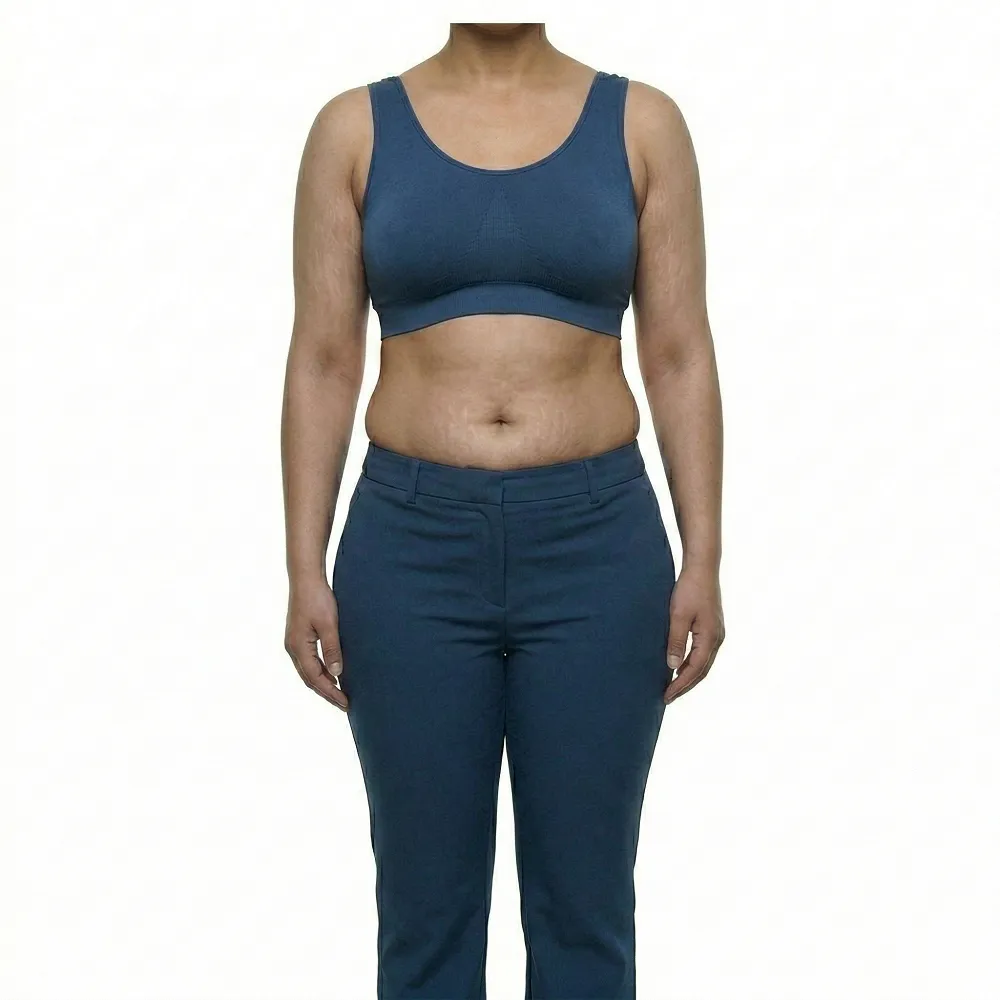 Headless clinical before photo of the same woman displaying a beautifully toned, naturally athletic abdomen and sculpted waistline following 4D body contouring at Dina Elite, serving the Gulf region 