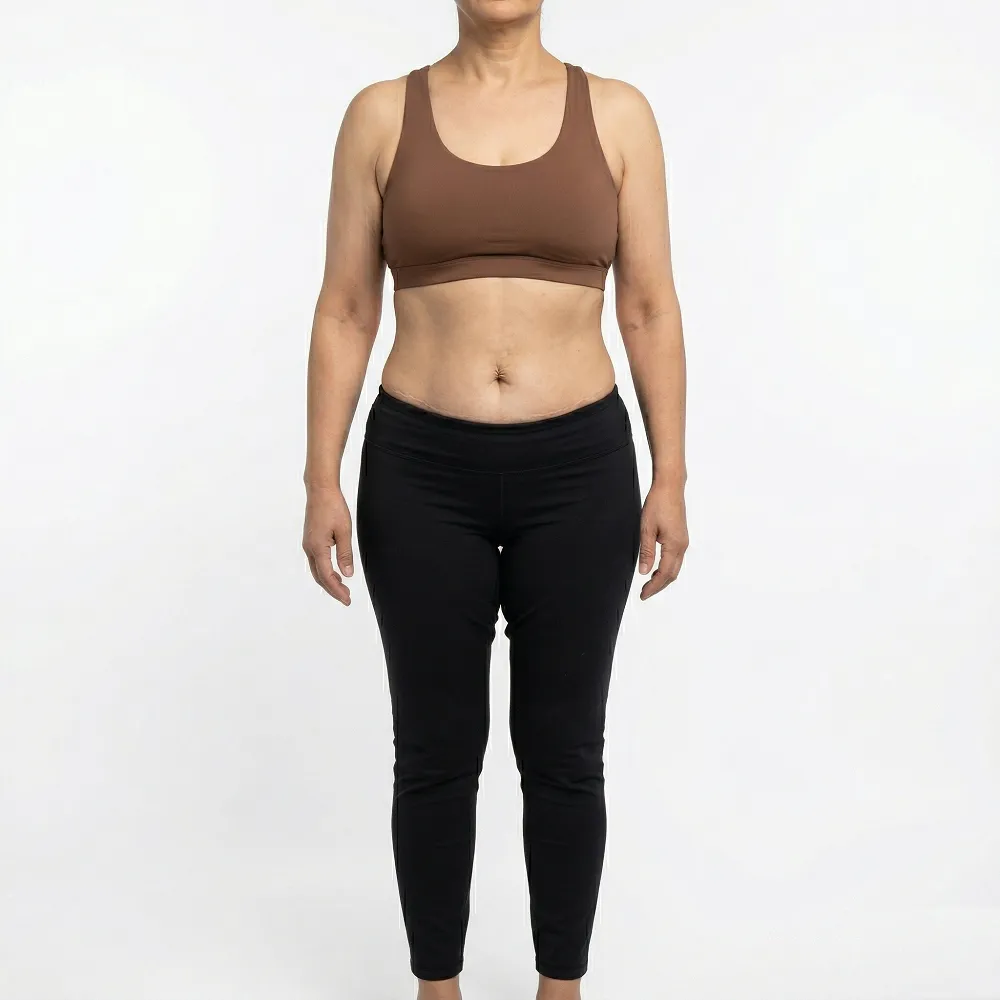 Headless clinical after photograph of the same Middle Eastern woman, displaying a dramatically sculpted, athletic physique with carved six pack abs and defined muscle tone following an advanced surgical body contouring procedure at Dina Elite, serving the Gulf region 