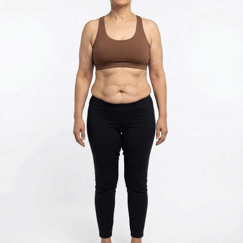 Headless clinical before photograph of a Middle Eastern woman's natural body contour, indicating areas of skin laxity and fullness in the abdomen and arms, prior to body contouring surgery at Dina Elite for patients from the Gulf 