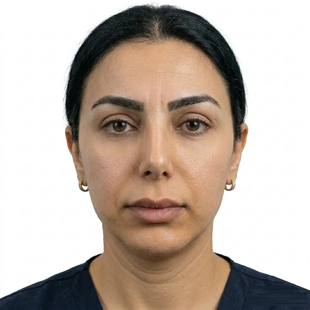 Close up frontal transformation shot after an Endoscopic Brow Lift in Cairo, Egypt  Showcasing lifted, naturally positioned brows, smoothed forehead furrows, and vibrant eyes, with no visible scarring  Curated results for elite GCC clients accustomed to Riyadh and Dubai healthcare standards  Minimal swelling and exclusive luxury recovery in Cairo 