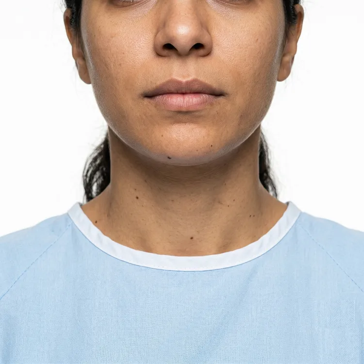 Close up frontal view of a patient presenting with uneven skin tone, visible hyper pigmentation, and generalized darkening across the face and neck, showcasing dynamic areas for advanced Skin Lightening treatment at Maraya Clinic, Heliopolis, Cairo, Egypt 