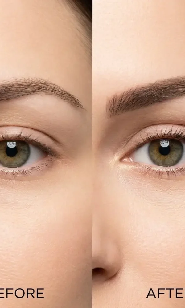 مقارنة قبل وبعد تجميل العيون اللوزية (Cat Eyes) بتقنيات غير جراحية في عيادة مرايا كلينك بالقاهرة مع الدكتورة دينا خليل 